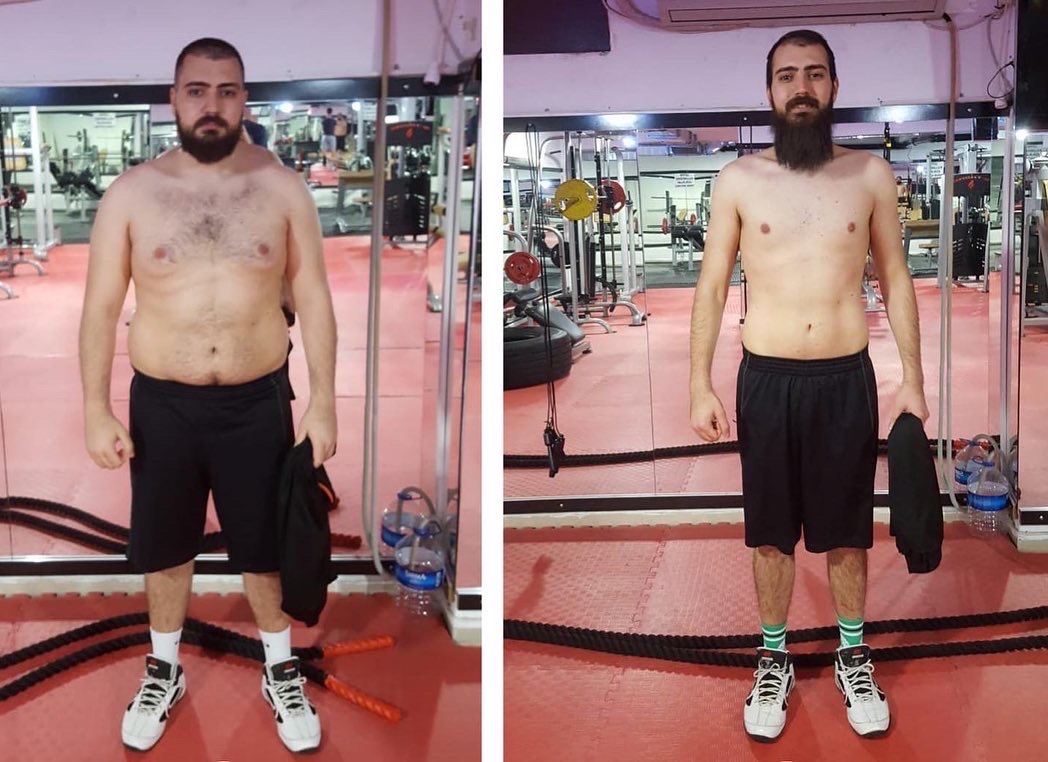 Before After Transformation 14